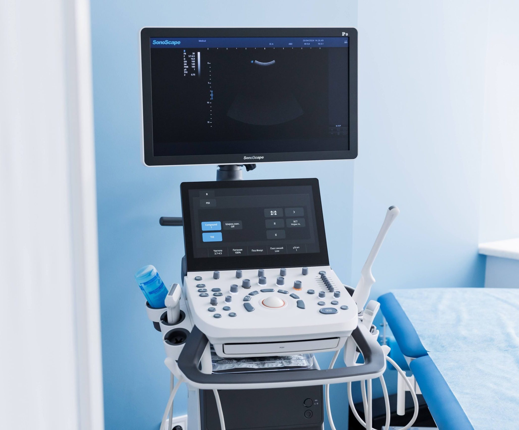 Сучасний ультразвуковий апарат