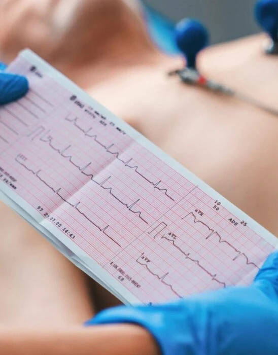 Діагностика серця методом ЕКГ